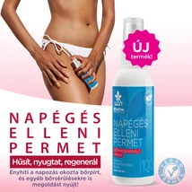 Wise Tree Naturals Napégés elleni permet (100 ml)