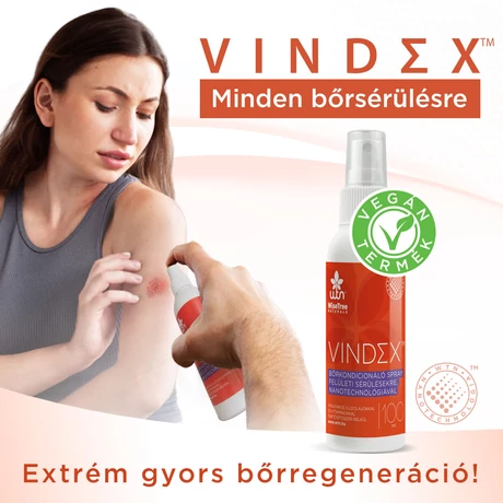 Wise Tree Naturals Vindex (1 db)
